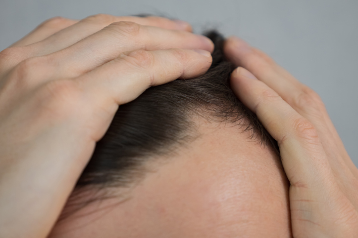 '탈모의 성지' 이스탄불서 모발이식받던 30대 관광객 사망 - 뉴스 썸네일 이미지