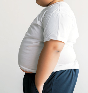 전세계 아동 비만율, 저체중률 처음 앞질러… “기업들 이윤따라 비윤리적 마케팅”[Science]