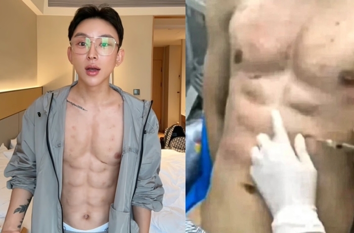 ‘8팩 복근’ 만들기 위해 ‘8억’ 쓴 청년