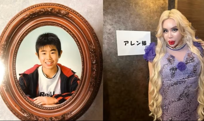 어린시절 왕따였던 남성, 10억 들여 200회 전신 성형