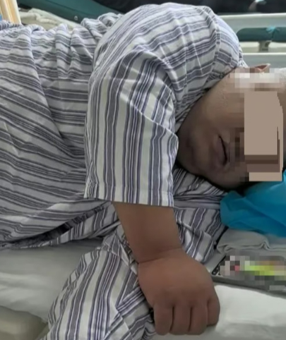 ‘아무리 사랑이 좋다지만’···여친 부모에 잘 보이려 위 수술했다가 사망한 130kg 男