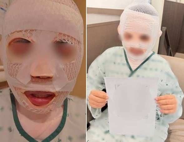 한국 남자친구의 폭행 피해를 입은 태국인 여성. 페이스북