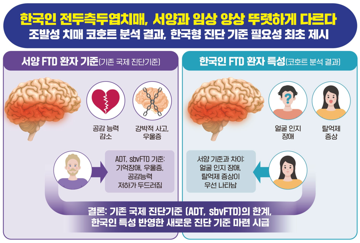 ‘젊은 치매’ 한국인과 서양인 증상 달랐다