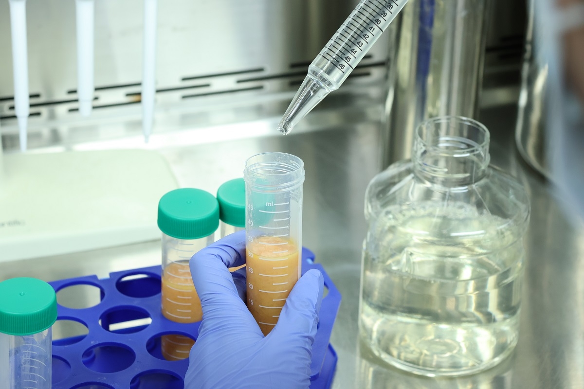 '셀 뱅킹' 지방줄기세포, 10년 뒤 항노화 치료에 쓰인다 - 뉴스 썸네일 이미지