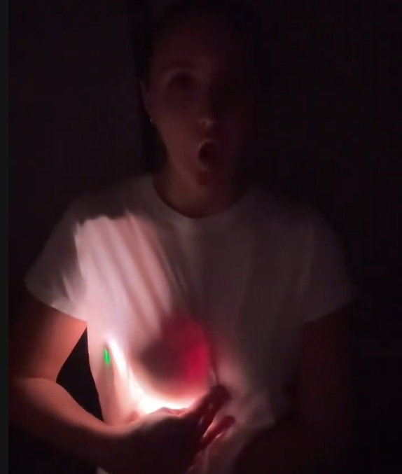 “내 가슴에서 빛이?”…가슴 성형 후 불 비추자 생긴 일 공유 SNS서 ‘화제’