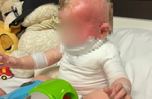 생후 9개월 호주 아기에 뜨거운 커피 끼얹고 도주한 중국인