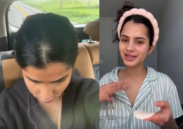 ‘보드카 한 병은 일상’…알코올 중독 여대생, 치아 썩고 탈모 증상까지