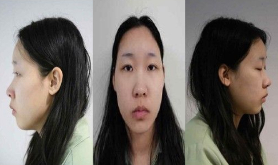 [속보]모텔 연쇄살인 피의자 신상 공개…20세 김소영