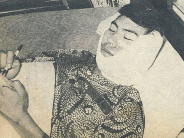 나훈아는 1972년 무대에서 피습당해 왼쪽 뺨을 72바늘이나 꿰매야 했다. 자료사진