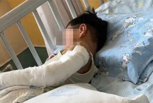 배달 간 엄마가 오는지 보려다 아파트 11층에서 추락한 4살 소년이 기적적으로 목숨을 건졌다.