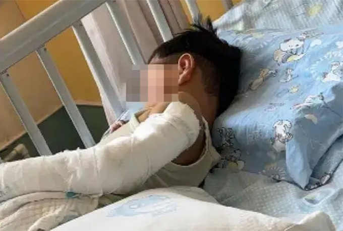 “엄마 언제 와?” 11층서 창밖 보다 추락 4세 아이[아하중국]