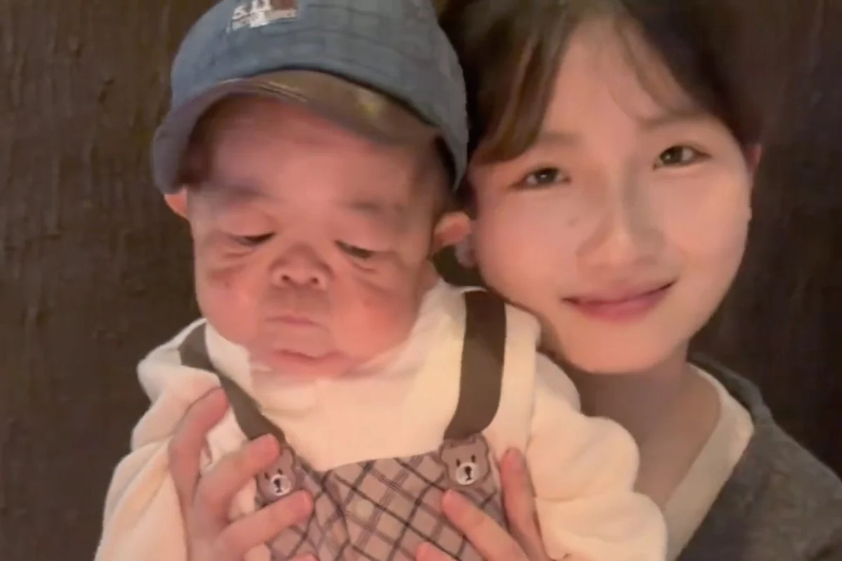 25살인데 키 66cm...희귀병 오빠 평생 돌보겠다는 21세 여동생