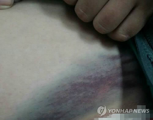 전북 전주에서 한 여중생이 동료 학생들에게 감금, 폭행을 당해 경찰이 조사에 나섰다. 이 학생의 가족에 따르면 가해 학생들은 이 여중생을 6시간 동안 끌고 다니며 감금하고 폭행했다.