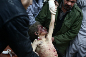 시리아 다마스쿠스 북동부 도우마의 반군 장악 지역에서 6일 시리아 정부군의 공습으로 부상당한 한 소년이 인근에 마련된 병원에서 응급 치료를 받고 있다.