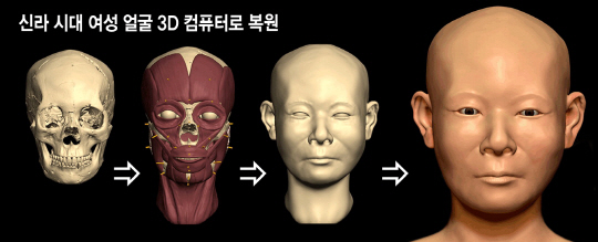 서울대 의대 법의학연구소는 2013년 경북 경주에서 발굴된 유골의 머리뼈를 최근 복원하고, 컴퓨터단층촬영(CT)과 3D 컴퓨터 디지털 모델제작 프로그램 등을 이용해 신라 시대 여성의 얼굴 모습을 복원했다.