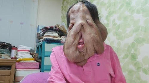 SBS TV ‘세상에 이런 일이’