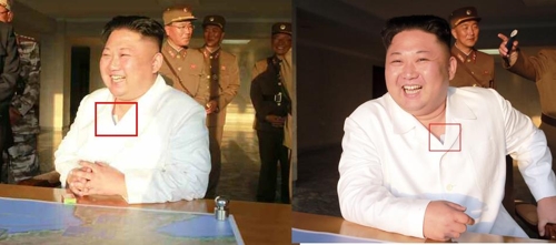 양쪽 가슴에 파스를 붙인 김정은 노동당 위원장. (왼쪽 사진 노동신문, 오른쪽 사진 조선중앙통신)