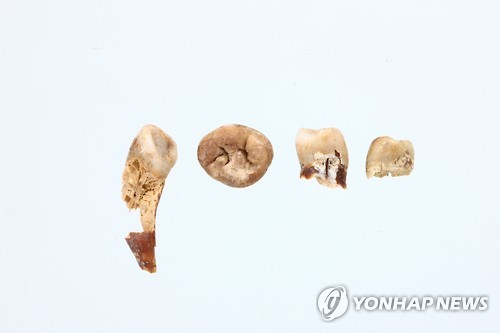 익산 쌍릉 대왕묘에서 나온 치아.[연합뉴스 자료사진]