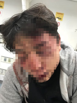 대리 기사를 기다리다 영문도 모른채 폭행당한 대학생.