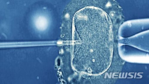 【서울=뉴시스】체외 인공수정이 이뤄지고 있는 모습. 중국에서 지난해 12월 톈톈이라는 남자아이가 라오스 대리모에 의해 태어났다. 톈톈의 부모는 지난 2013년 교통사고로 숨졌는데 당시 체외수정한 수정란을 냉동보관하고 있었다. 톈톈의 조부모들의 오랜 법정 소송 끝에 대리모를 이용한 톈톈의 출생을 허락받아 부모 사망 4년여 후에 톈톈이 태어나게 됐다. <사진 : 영 BBC> 2018.4.12