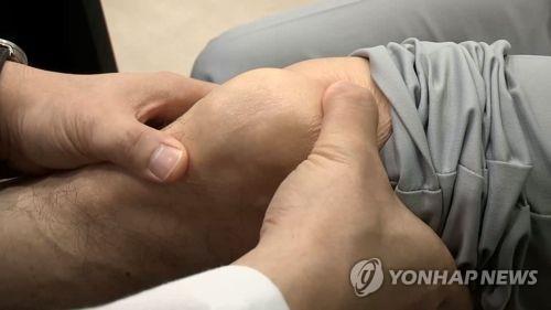 무릎통증[연합뉴스TV 제공]