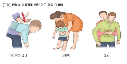 [서울아산병원 제공]