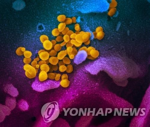 신종 코로나바이러스[미 NIH 국립 알레르기 감염병 연구소 제공]