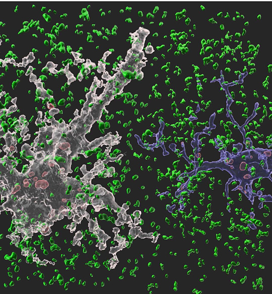 뇌에서 뉴런을 도와 뇌 항상성 유지 역할을 수행하는 세포인 별아교세포(하얀색)와 미세아교세포(파란색)가 불필요한 시냅스를 제거하고 있는 전자현미경 모습.