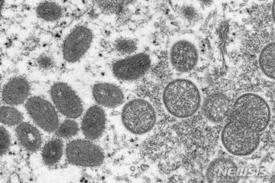 미국 질병통제예방센터(CDC)가 공개한 원숭이두창 바이러스 모습. AP 뉴시스