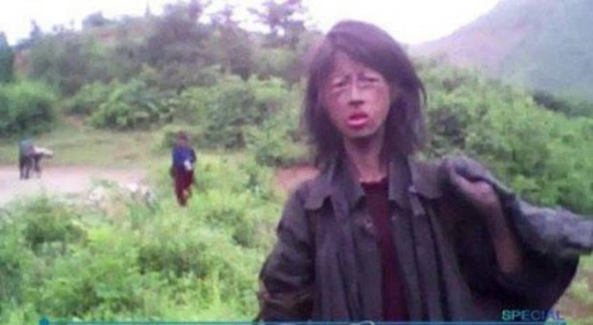 뼈만 남은 처참한 몰골로 자신이 먹을 토끼풀을 뜯는 영상이 국내외 TV로 방송돼 충격을 줬던 북한의 20대 ‘꽃제비’ 여성. 사진은 지난 2010년 보도된 KBS 스페셜 영상 캡처
