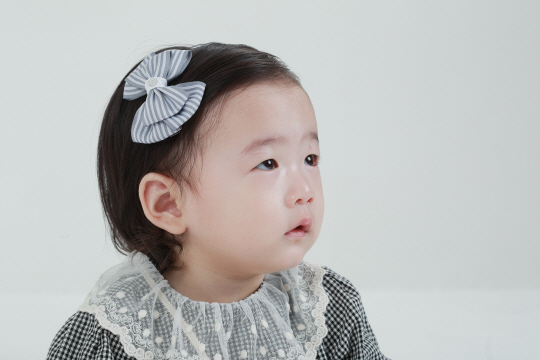 어린아이들도 속눈썹이 안구를 찌르거나, 눈꺼풀이 눈을 과도하게 덮고 있으면 쌍꺼풀 수술을 시행한다. 김안과병원 제공