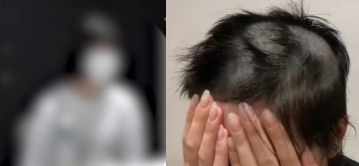 남자친구에게 감금당한 채 바리캉으로 머리를 밀리고 성폭행과 폭행 등 학대행위를 당한 피해자의 모습. 유튜브 ‘카라큘라 탐정사무소’· MBC ‘실화탐사대’ 캡처