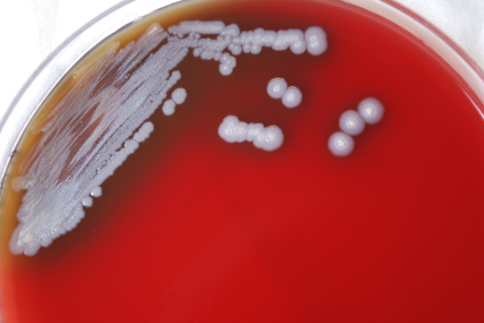 2022년 7월 미국 질병통제예방센터가 공개한 유비저균(Burkholderia pseudomallei) 모습. AP 뉴시스