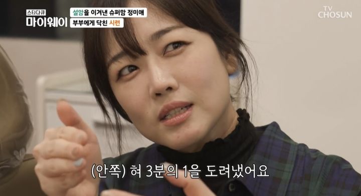 [서울=뉴시스] 지난 3일 방송된 TV조선 ‘스타다큐 마이웨이’에 트로트가수 정미애가 출연했다. (사진=TV 조선 ‘스타다큐 마이웨이’ 캡처) 2023.12.04.