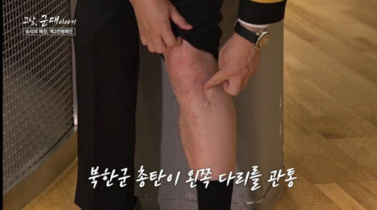 이희완 국가보훈부 차관 후보자가 현역 시절 제2연평해전 당시 북한군 총탄에 맞은 왼쪽 다리를 보여주고 있다. 국방일보 제공
