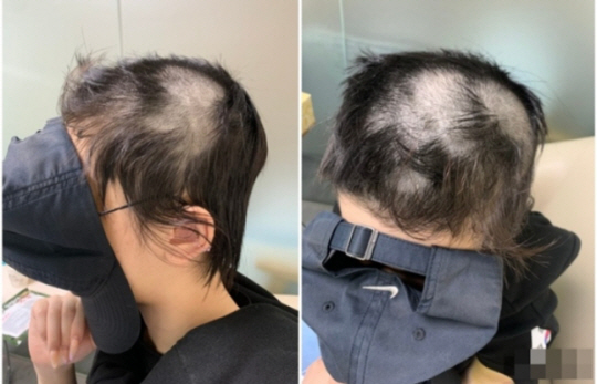 피해자 측이 게시한 사진. 인터넷 커뮤니티 캡처