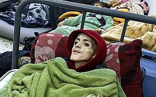 영양실조로 사망한 가자지구 소년 야잔 카파르네. AFP 연합뉴스