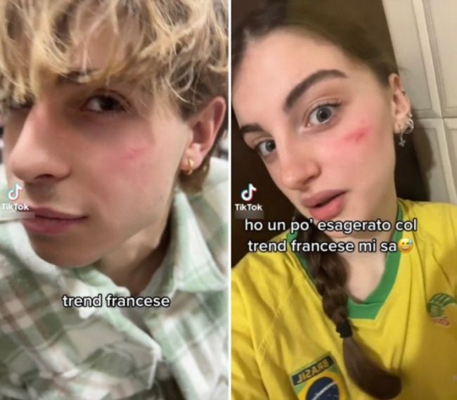 지난해 이탈리아를 비롯해 각국에서 인기를 끈 ‘프렌치 흉터 챌린지’에 참여한 10대들의 모습.   틱톡 캡처