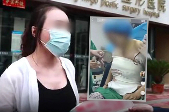 최근 자신의 성형 장면을 인터넷에서 확인한 것으로 알려진 가오 씨와 인터넷에 떠도는 가오 씨의 영상. SCMP 캡처