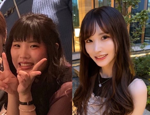 [서울=뉴시스] 28일 산케이신문은 전 연인에게 외모 지적을 받고 헤어진 뒤 1800만엔(1억7000만원)을 들여 전신 성형을 한 일본 여성 ‘라라’를 소개했다.  (사진=X 갈무리)