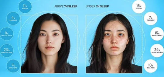 영국 매트리스 및 침구 제조 업체인 심바가 AI를 통해 도출한 수면 부족의 영향 이미지. 왼쪽 사진은 7시간 이상 수면한 경우, 오른쪽은 7시간 미만 수면. 뉴시스(심바 캡처)