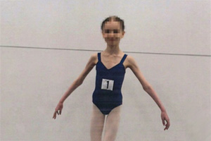 17살에 27kg? 딸에게 야채만 먹인 호주 부모, 감옥행