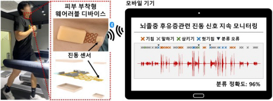 포스텍·스위스 공동 연구팀이 개발한 피부 부착형 센서 시스템. 포스텍 제공