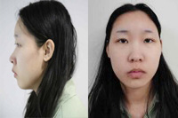 “檢, 사이코패스 김소영에 속은 것…개가 웃을 일” 프로파일러의 비판